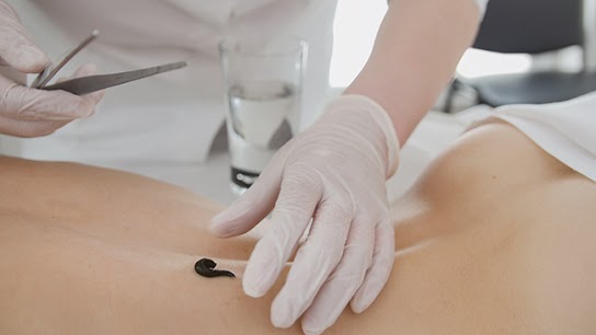 They are highly effective and easy-to-use measures to prevent a wound from ripening and heal faster unless you are in a hurry.  The Home Doctor Guide